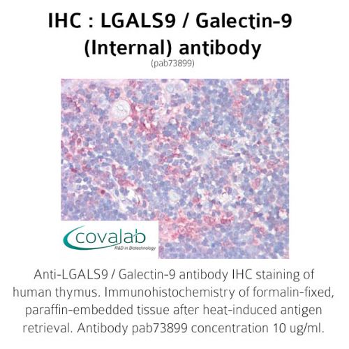 LGALS9 / Galectin-9 (Internal) antibody