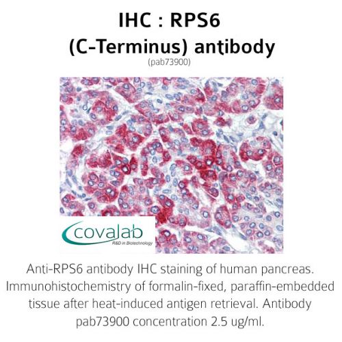 RPS6 (C-Terminus) antibody