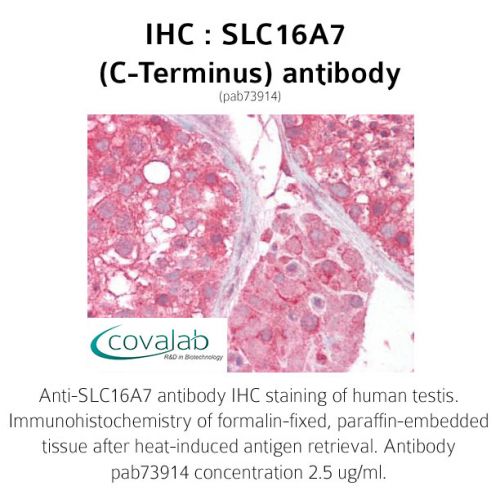 SLC16A7 (C-Terminus) antibody