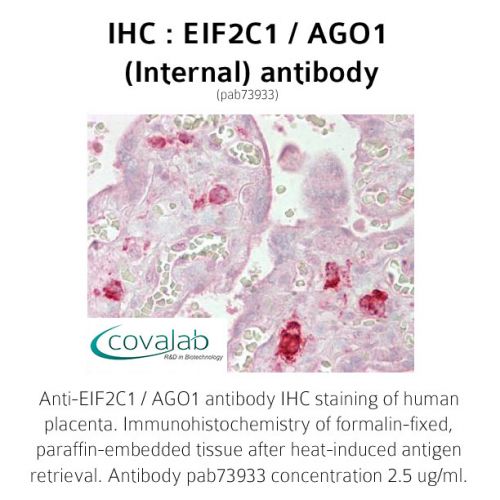 EIF2C1 / AGO1 (Internal) antibody