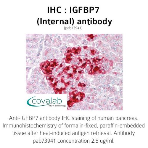 IGFBP7 (Internal) antibody