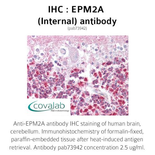 EPM2A (Internal) antibody