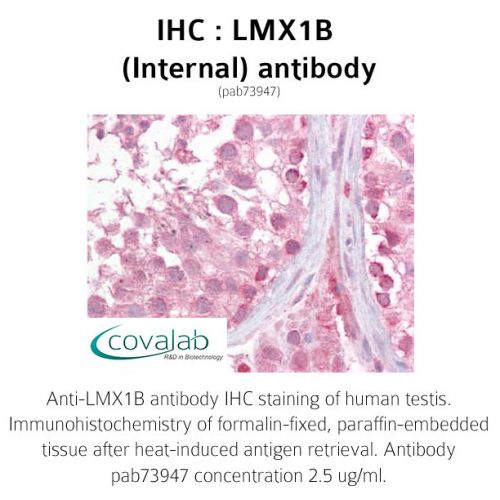 LMX1B (Internal) antibody