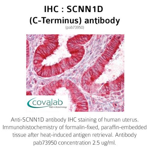 SCNN1D (C-Terminus) antibody