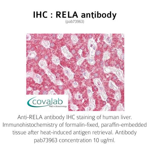 RELA antibody