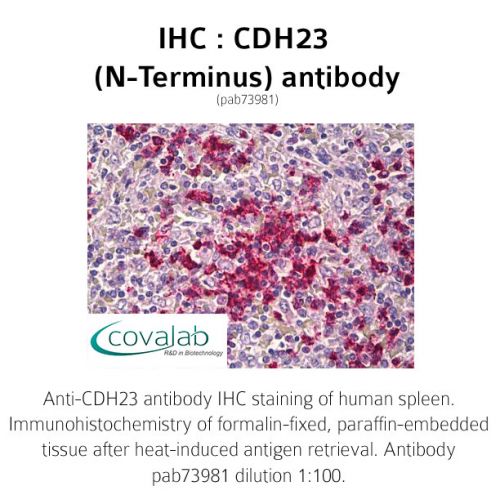 CDH23 (N-Terminus) antibody