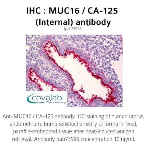 MUC16 / CA-125 (Internal) antibody