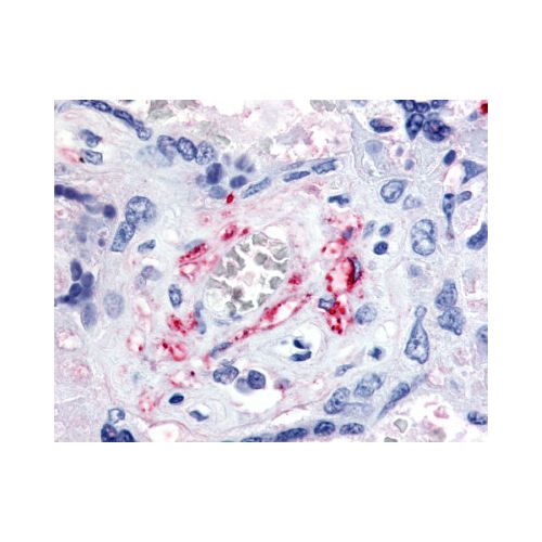 VEGFR1 (N-Terminus) antibody