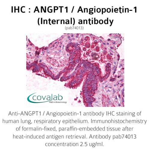 ANGPT1 / Angiopoietin-1 (Internal) antibody