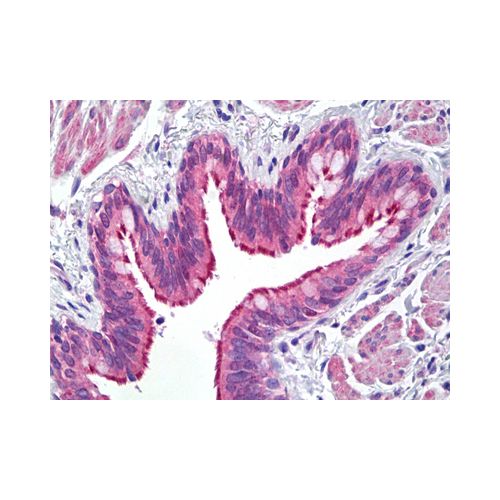 ATP7B (N-Terminus) antibody