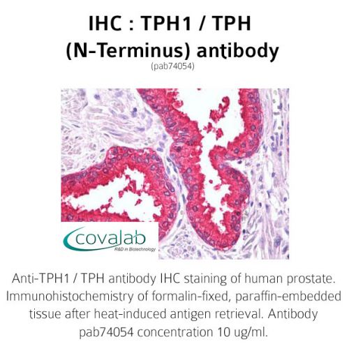 TPH1 / TPH (N-Terminus) antibody