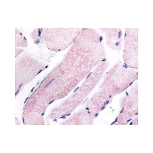 WNK1 (Internal) antibody