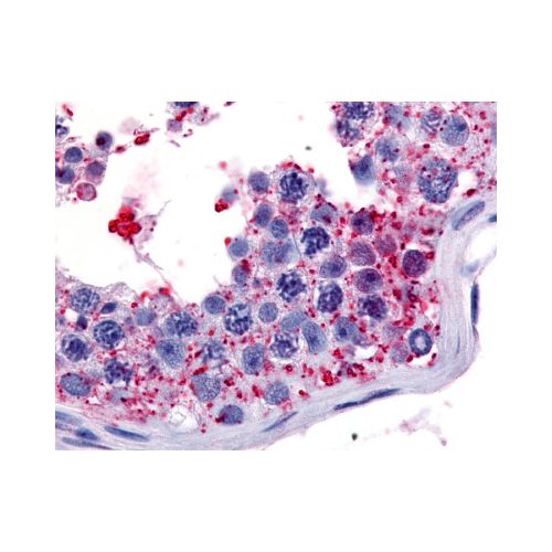 WNK1 (Internal) antibody