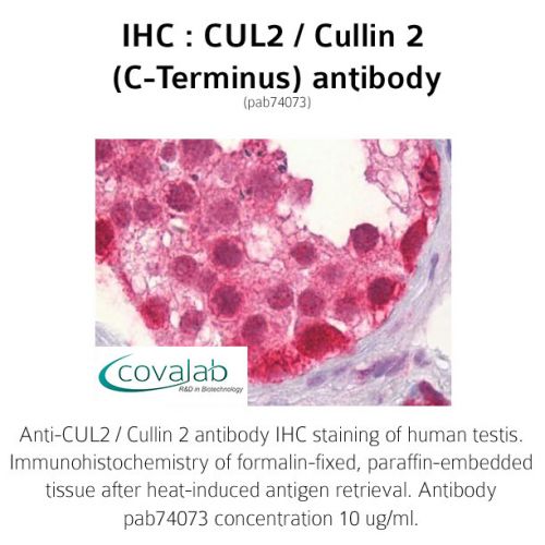 CUL2 / Cullin 2 (C-Terminus) antibody