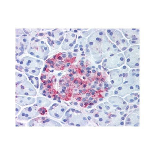 WNT10A (Internal) antibody