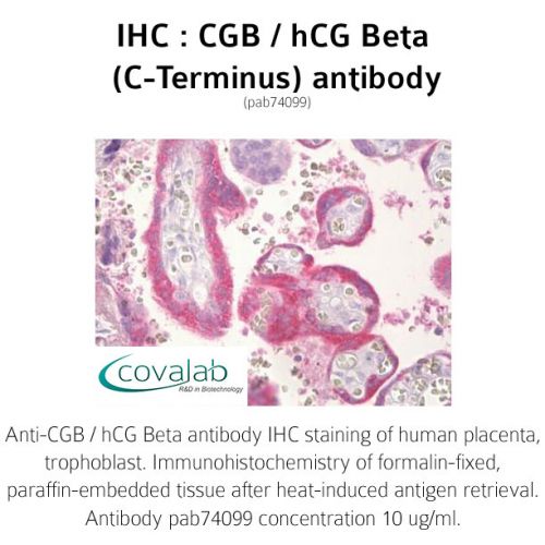 CGB / hCG Beta (C-Terminus) antibody
