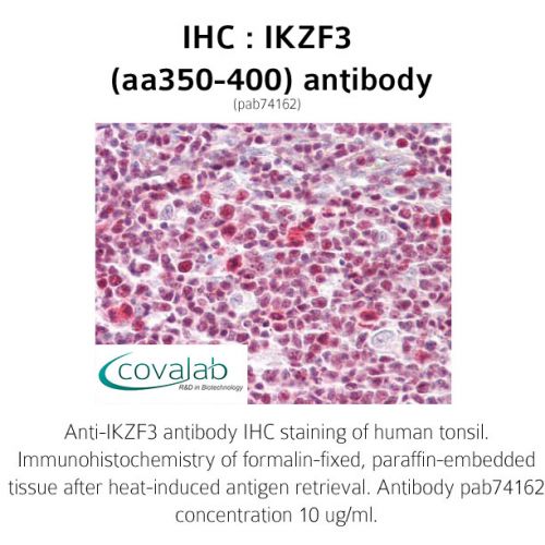 IKZF3 (aa350-400) antibody
