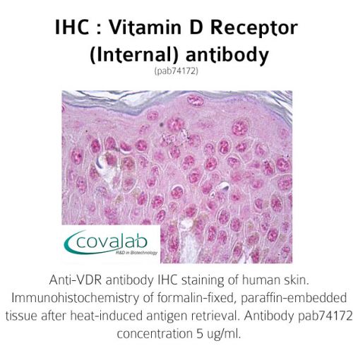 Vitamin D Receptor (Internal) antibody
