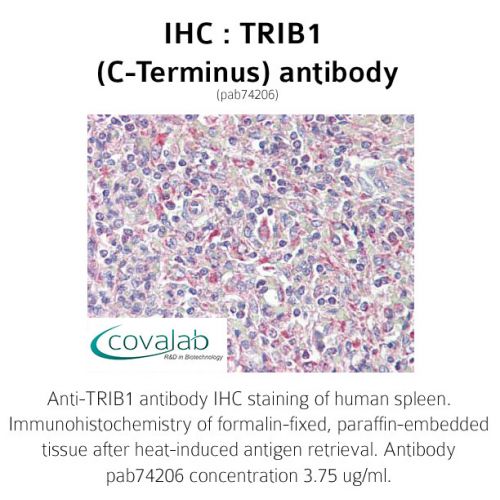 TRIB1 (C-Terminus) antibody