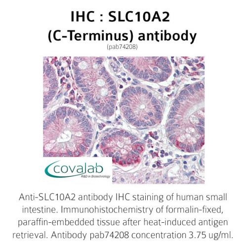 SLC10A2 (C-Terminus) antibody