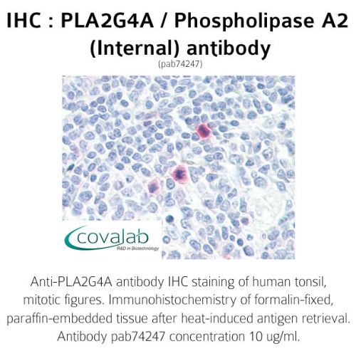 PLA2G4A / Phospholipase A2 (Internal) antibody