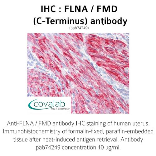 FLNA / FMD (C-Terminus) antibody