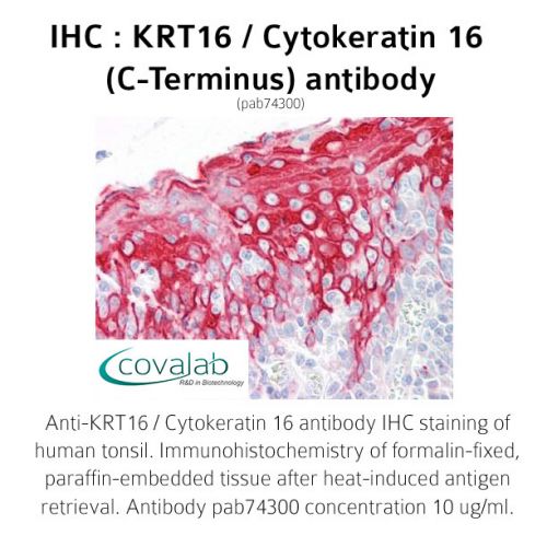 KRT16 / Cytokeratin 16 (C-Terminus) antibody