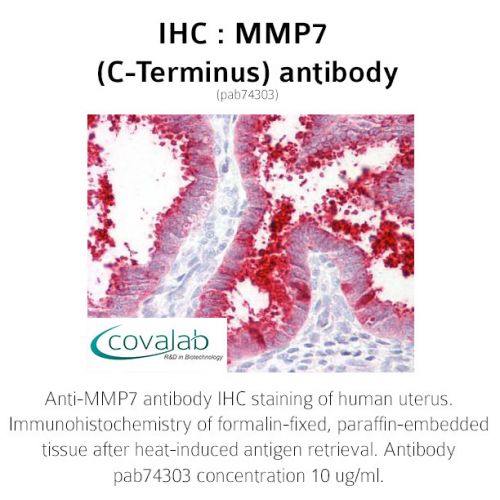 MMP7 (C-Terminus) antibody