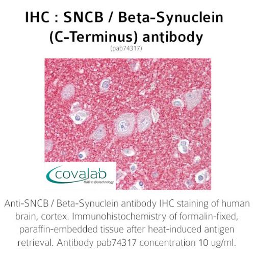 SNCB / Beta-Synuclein (C-Terminus) antibody