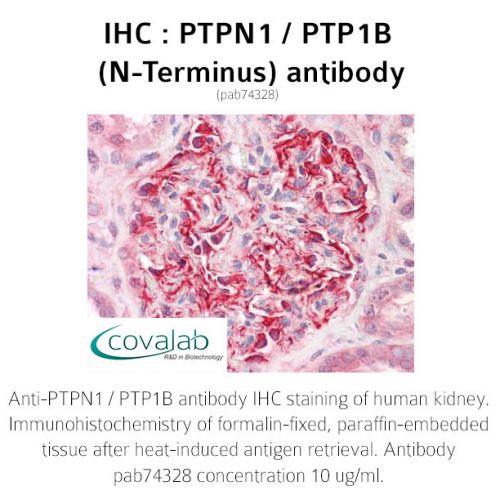 PTPN1 / PTP1B (N-Terminus) antibody