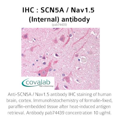 SCN5A / Nav1.5 (Internal) antibody