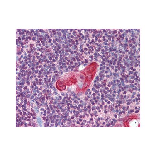 TLX1 (aa300-330) antibody