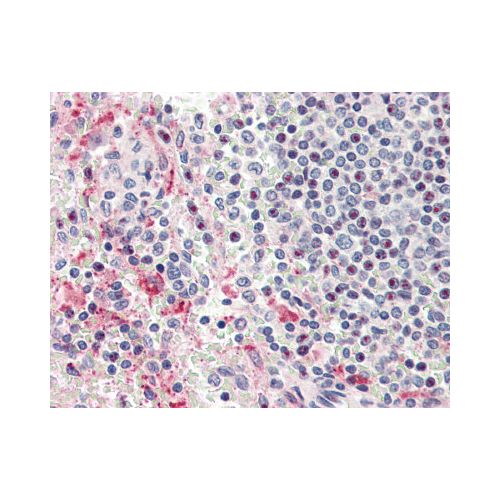 Heparanase antibody