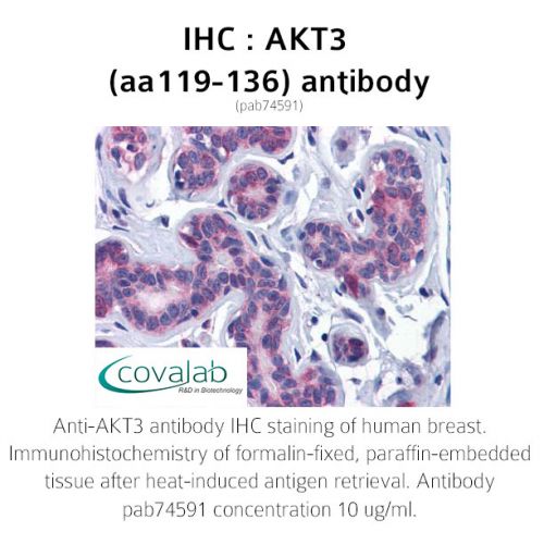 AKT3 (aa119-136) antibody