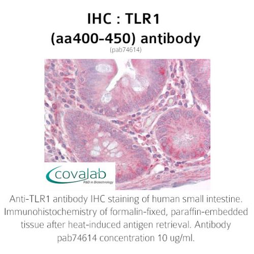 TLR1 (aa400-450) antibody