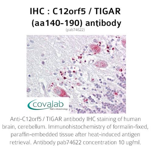 C12orf5 / TIGAR (aa140-190) antibody