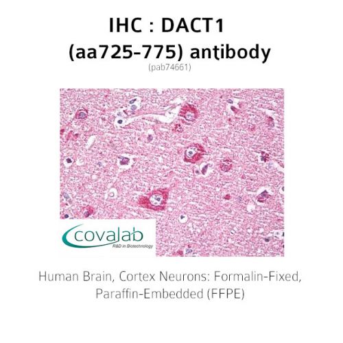 DACT1 (aa725-775) antibody