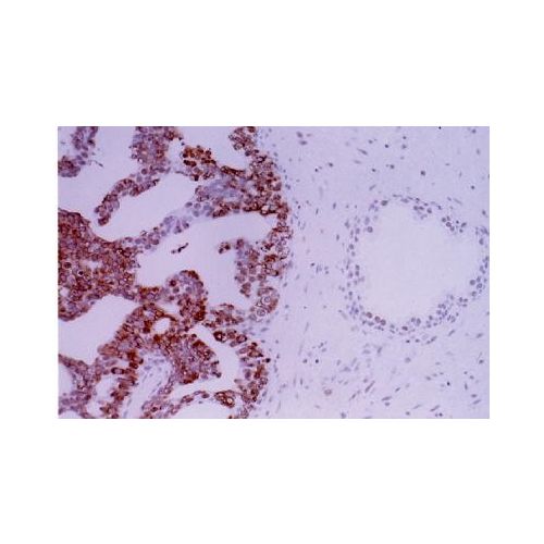 DNA-(apurinic or apyrimidinic site) lyase (APE-1) antibody