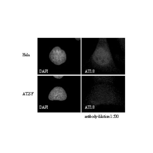 ATM antibody