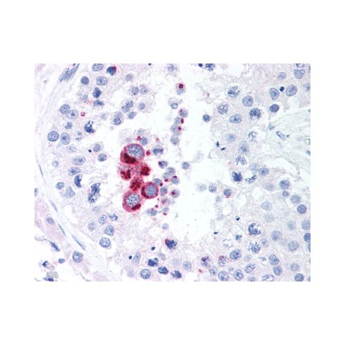 TBK1 antibody (108A429)