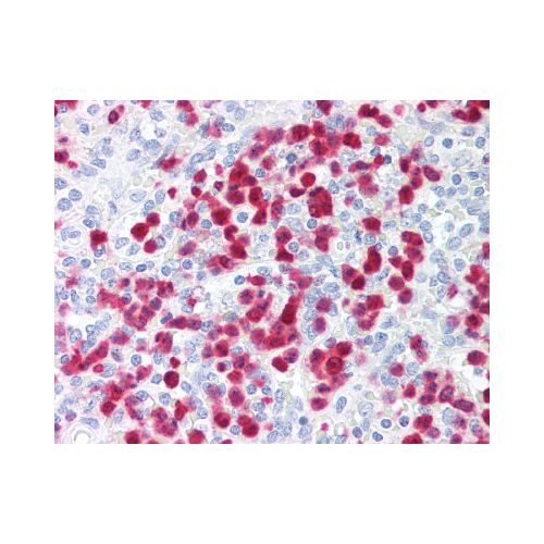 S100A8 (CF-145) antibody