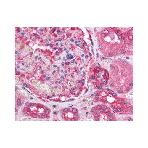 ATM (aa980-1512) (3E8) antibody