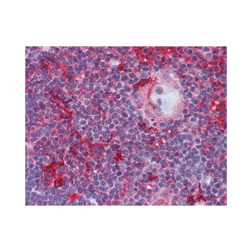 LCK antibody (33D196)