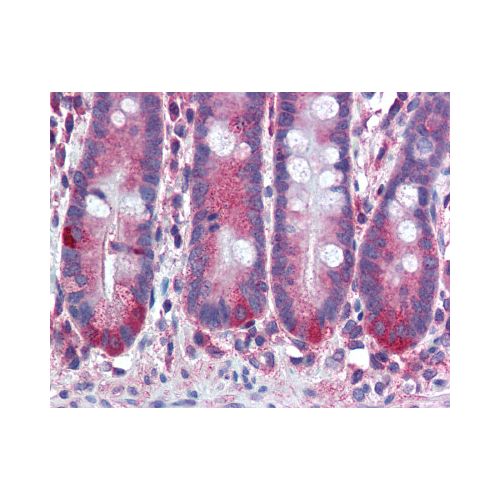 MMP11 (SL3.05) antibody