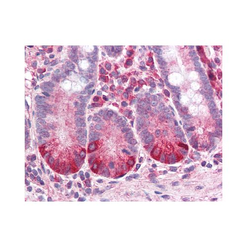 CXCR2 antibody