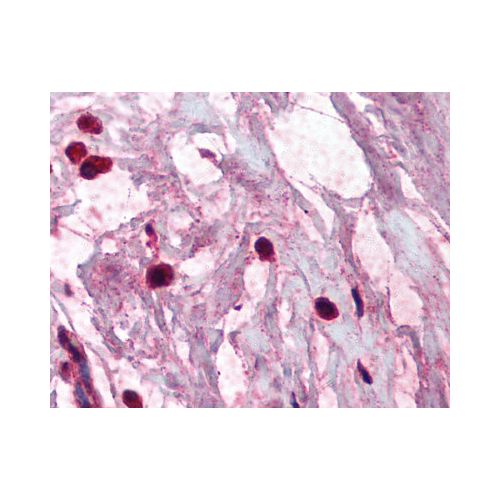TPSAB1 / Mast Cell Tryptase (AA1) antibody