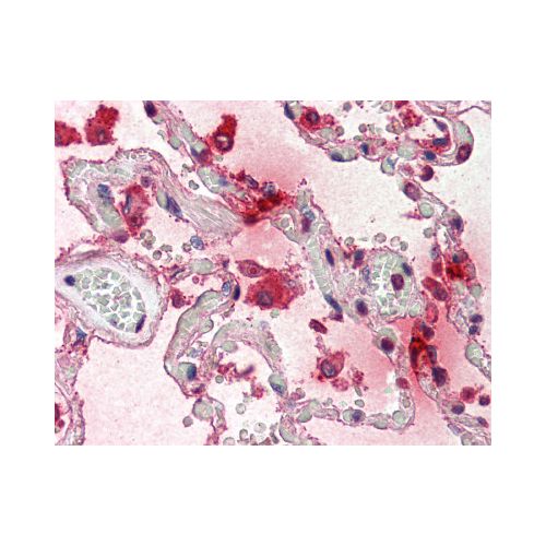 TPSAB1 / Mast Cell Tryptase antibody