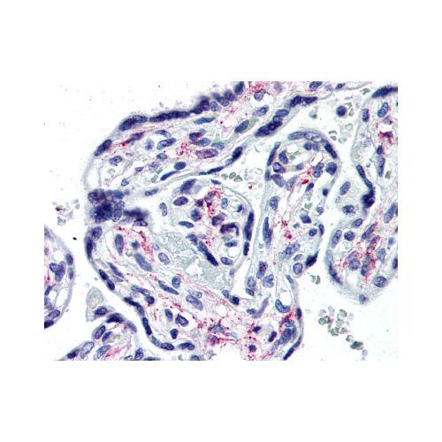 IL1R1 (Extracellular Domain) (40101) antibody