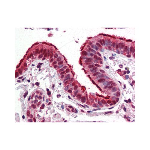 FOXP1 antibody (JC12)