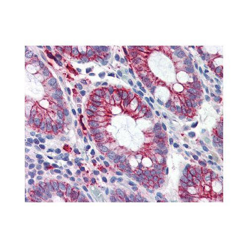 Integrin Beta 1 (aa34-141) (K2D5) antibody